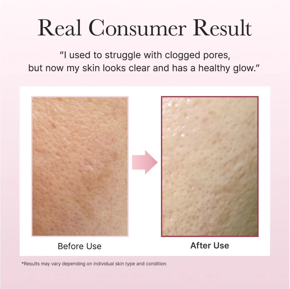 FRESH ROSEHIP RICE MOCHI CLEANSER