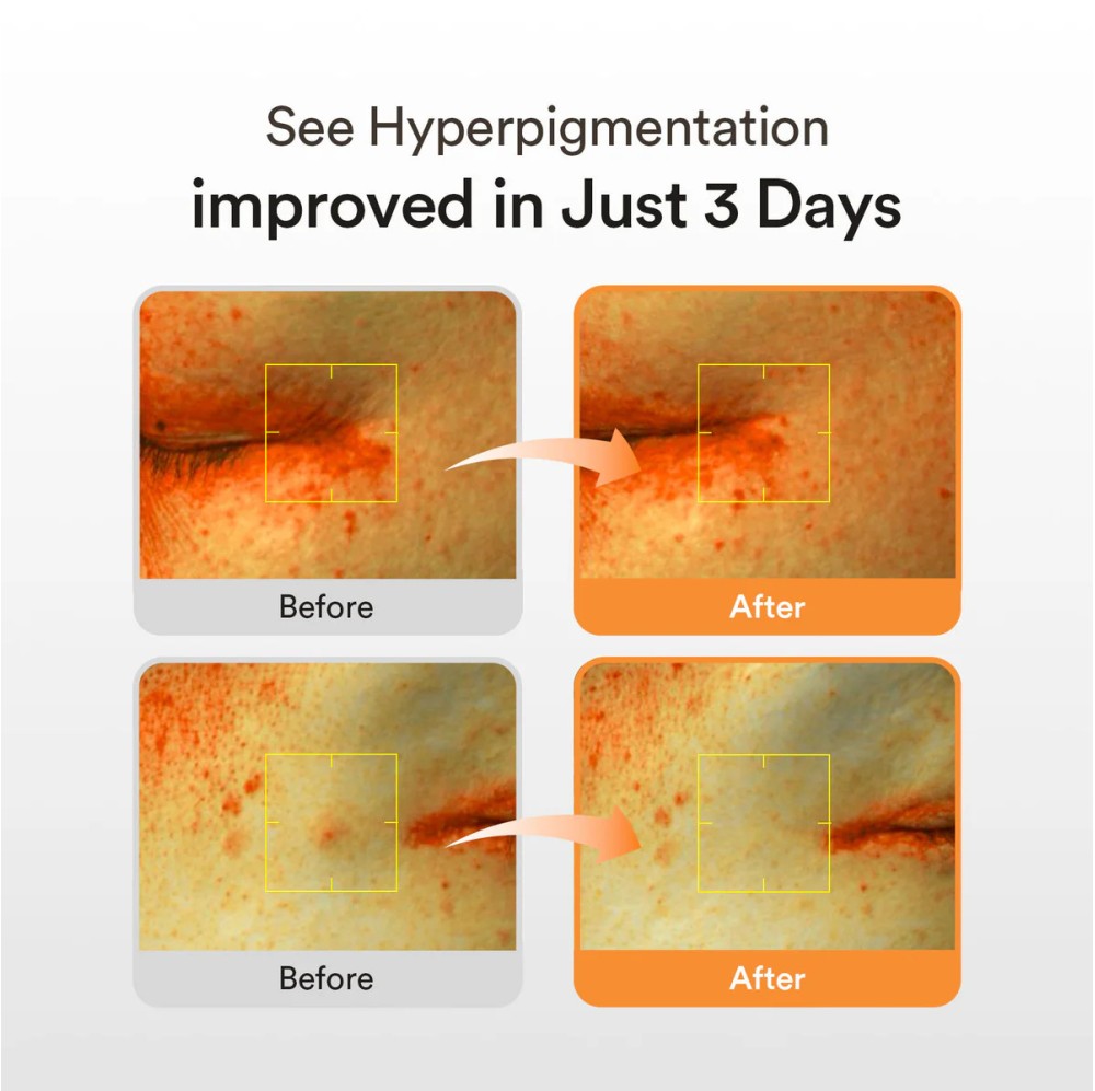 GLUTATHIOSOME DARK SPOT SERUM