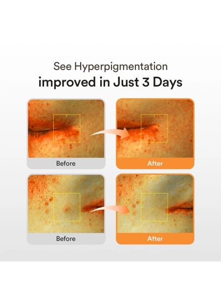 GLUTATHIOSOME DARK SPOT SERUM